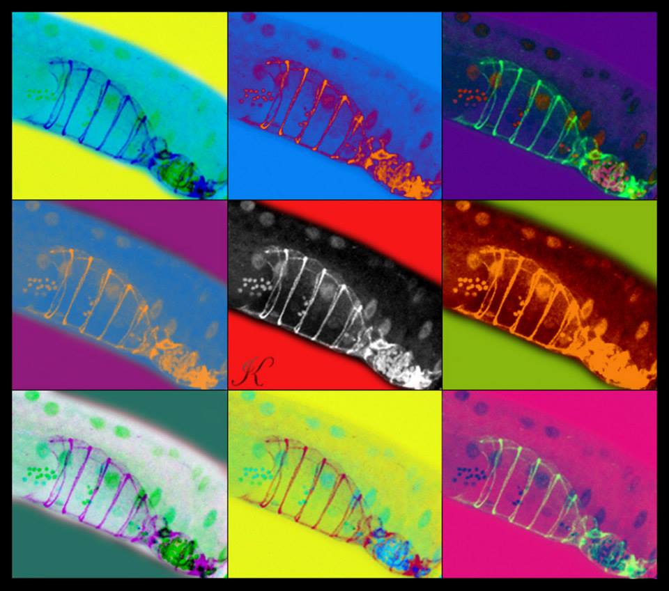 В центре - черно-белое изображение репродуктивной системы нематоды, флуоресцентный микроскоп, увеличение 1 000. Вокруг раскрашенные копии.