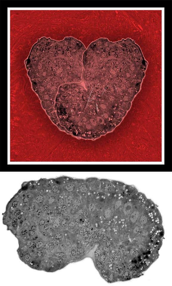 Срез эмбриона нематоды C. elegans. Снизу изображение под просвечивающим электронным микроскопом, увеличение 4 200. Вверху - после модификации в Photoshop. Третья премия «Micro-Art» на Международном конгрессе C. elegans в Лос-Анджелесе, 2015 г.